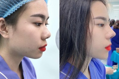 NÂNG MŨI – KHÁCH CÓ TIỀN, NHƯNG KHÔNG NHẮN VÌ QUẢNG CÁO SAI CÁCH!