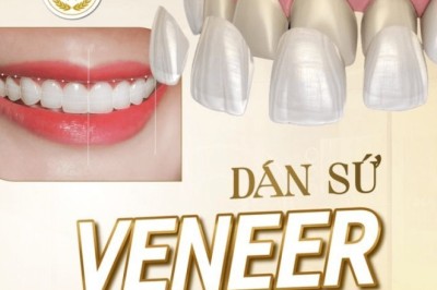 Đối Tác Nha Khoa