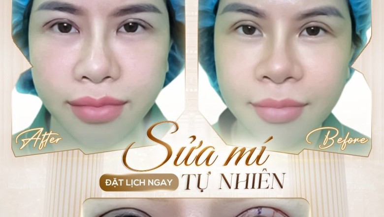 Thẩm mỹ Quốc tế ViVi – Đối tác chiến lược của AdsGoogle Việt Nam trong lĩnh vực Thẩm mỹ cao cấp