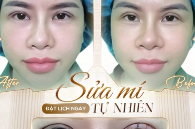 Thẩm mỹ Quốc tế ViVi – Đối tác chiến lược của AdsGoogle Việt Nam trong lĩnh vực Thẩm mỹ cao cấp